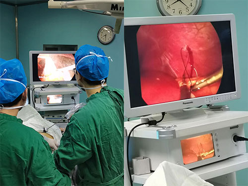 對(duì)肥胖大聲說(shuō)NO!——我院開(kāi)展腹腔鏡（微創(chuàng)）下胃部分切除術(shù)