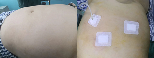 體重200斤的她，選擇了這個減肥方法