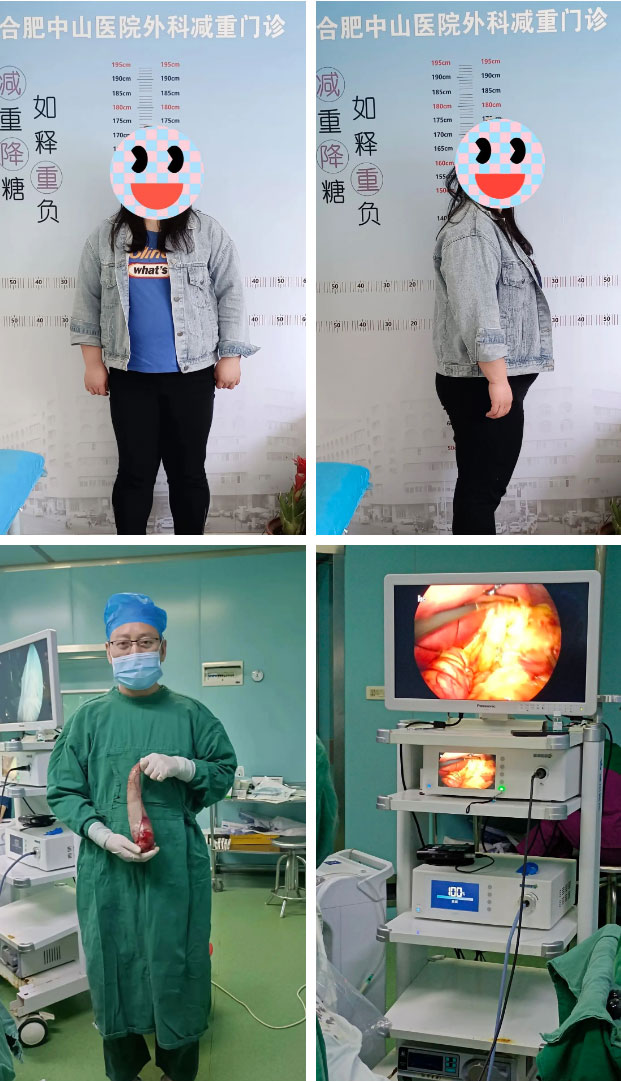 減重代謝手術(shù)，減的不只是“體重”