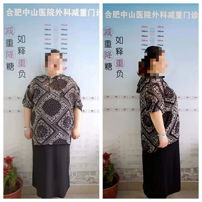 你的“難瘦”，我來“解圍”!