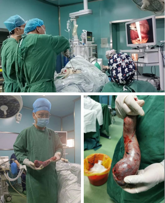 你還在忍受肥胖帶來的各種疾病嗎？