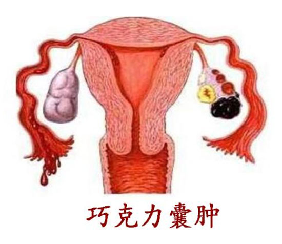 痛經(jīng)痛苦難捱，怎么辦？