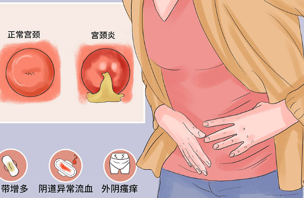 夏季婦科疾病高發(fā)，這些檢查要知道哦！