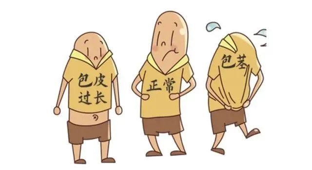 暑假割包皮，家長們關心的問題在這里