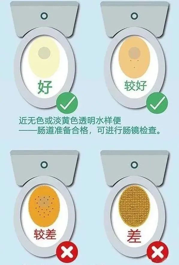 想做個腸鏡，需要做哪些準備呢？