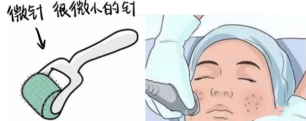 長痘、長斑、皮膚不好？這個活動你可不能錯過！