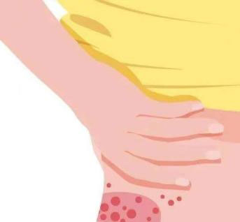 有一種劇痛叫“帶狀皰疹”，這些人群需警惕！