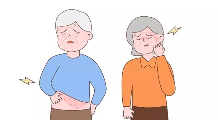 有一種劇痛叫“帶狀皰疹”，這些人群需警惕！