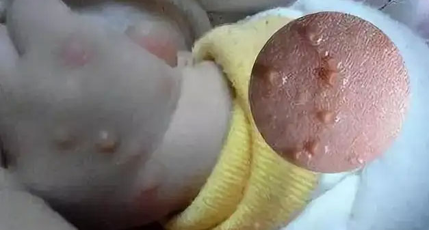 換季了，注意家里的小寶寶自己一點(diǎn)