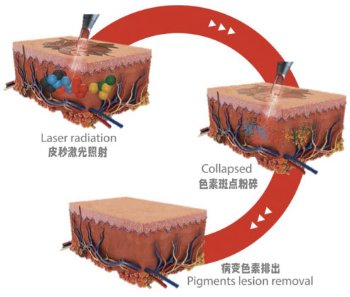 【早點下“斑”，煥膚新生】9.30皮秒日我們不見不散??！!