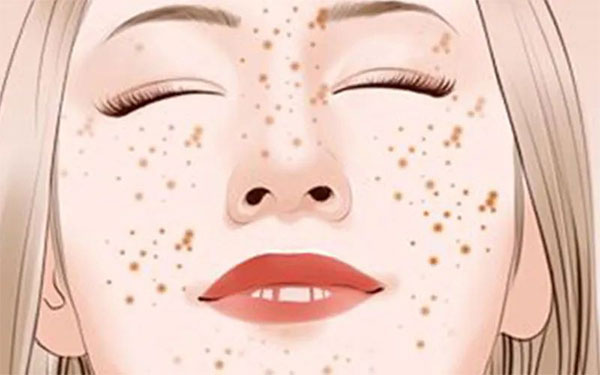 【早點下“斑”，煥膚新生】9.30皮秒日我們不見不散??！!