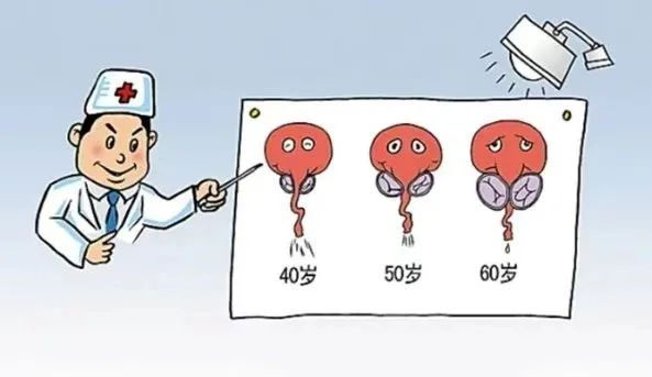 前列腺增生｜從癥狀到治療一文說清！