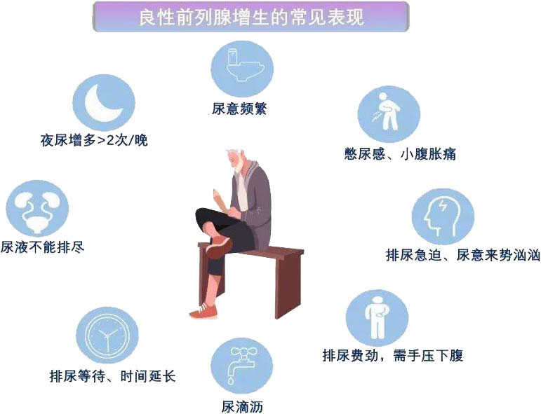 前列腺增生｜從癥狀到治療一文說清！