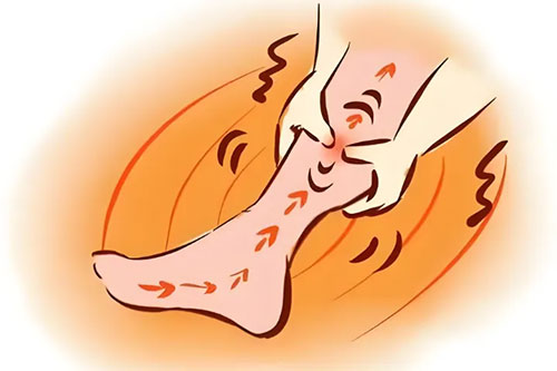 【惠民科普】會讓你的雙腿上爬滿“蚯蚓”的病癥——下肢靜脈曲張